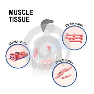 Types of muscle tissue.