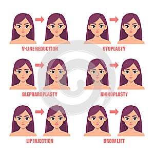 Types of plastic surgery on the face