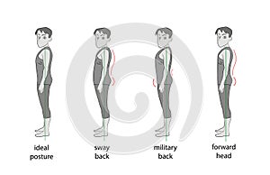 Types of posture in men. vector illustration.