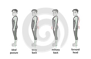 Types of posture in men. vector illustration.