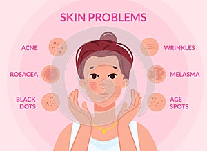 Types skin problems. Woman face with skins troubles, melasma pimple blemishes acne teenager problem blackhead cosmetic