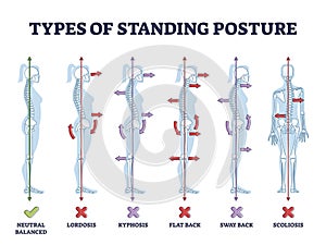 Types of standing postures and medical back pathology set outline diagram