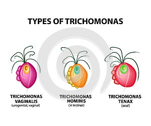 Types Trichomonads. Intestinal, oral, vaginal trichomonas structure. Trichomoniasis. Urogenital infection. Infographics. Vector photo