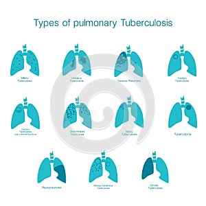 Tipos de. silueta compuesta de gráficos vectoriales médico ilustraciones de hombre cuerpo el organo 