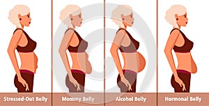 Types of Tummies for women. Post-pregnancy, menopausal hormonal belly, beer belly, bloating belly and overweight photo
