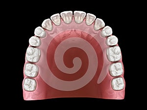 U-shape ovoid arch form of maxilla. Medically accurate tooth 3D illustration