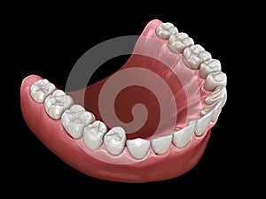 U-shape ovoid arch form of maxilla. Medically accurate tooth 3D illustration