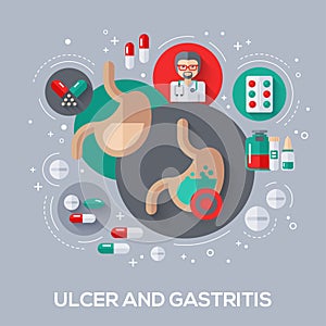 Ulcer and gastritis flat icons concept.