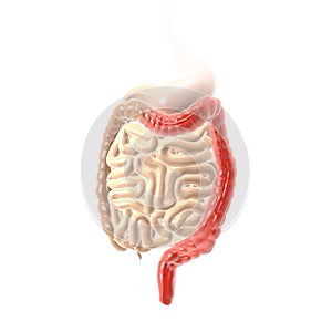 Ulcerative colitis UC, inflammation and ulcers of the colon and rectus, medically illustration