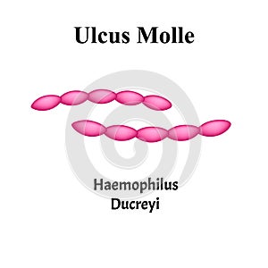 Ulcus Molle, Haemophilus ducreyi. Bacterial infections. Sexually transmitted diseases. Infographics. Vector illustration