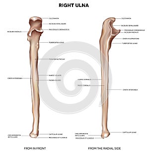 Ulna- from front and radial side