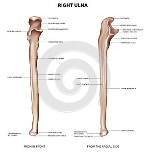 Ulna- from front and radial side photo