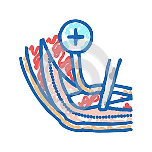 ulnar nerve release icon doodle illustration