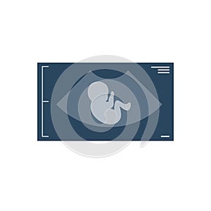 Ultra sound fetus unborn child icon. Simple illustration of ultra sound unborn child vector icon logo isolated on white background
