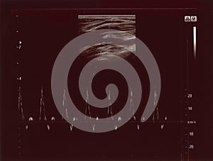 Ultrasonic diagnostic sonography photo