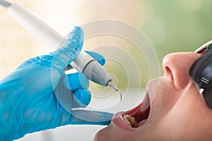 Ultrasonic teeth cleaning, close-up. Removal of tartar, plaque. Paradontitis, paradantoz. Dentistry, healthy teeth