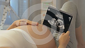 Ultrasonography exam of unborn child