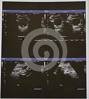 Ultrasonography of the upper abdomen with visualized portions of various organs. Translation