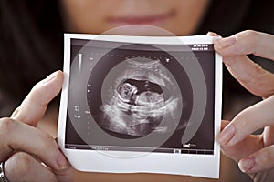 Ultrasound photo