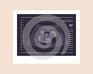 Ultrasound of baby. Embryo in womb. Pregnancy screening. Baby health diagnostic. Fetus silhouette photo. Sonography or