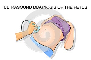 Ultrasound diagnosis of the fetus photo