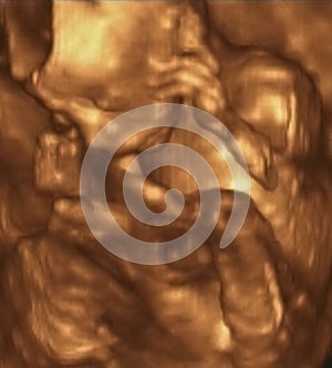Ultrasound Echography of a 4th Month fetus, Italy photo