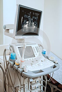 Ultrasound equipment. Diagnostics and sonography. Modern medical device.