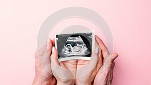 Ultrasound image pregnant baby photo. Woman hands holding ultrasound pregnancy picture on pink background. Pregnancy