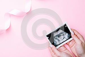 Ultrasound image pregnant baby photo. Woman hands holding ultrasound pregnancy picture on pink background. Pregnancy