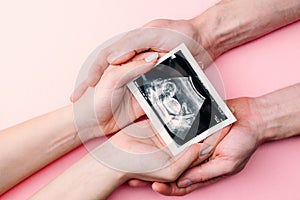 Ultrasound image pregnant baby photo. Woman hands holding ultrasound pregnancy picture on pink background. Pregnancy