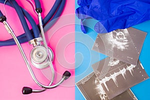 Ultrasound images and medical stethoscope in two colors background: blue and pink. Concept of preparation or completion of ultraso