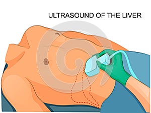 Ultrasound of the liver