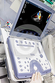 Ultrasound medical device in ICU