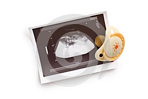 Ultrasound photo with pacifier