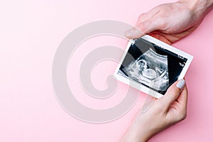 Ultrasound photo pregnancy baby. Woman hands holding ultrasound pregnant picture on pink background. Concept maternity