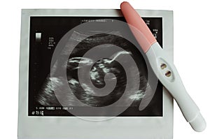 Ultrasound picture of baby with pregnancy test