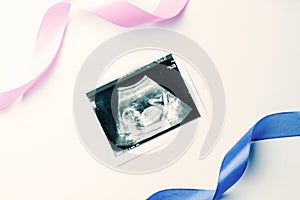 Ultrasound picture pregnant baby photo. Blue, pink ribbon with ultrasound pregnancy image on white background. Pregnancy