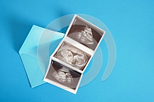 Ultrasound picture pregnant baby photo and envelope on blue background