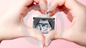 Ultrasound picture pregnant baby photo. Woman hands holding ultrasound pregnancy image on pink background. Concept of