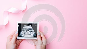 Ultrasound picture pregnant baby photo. Woman hands holding ultrasound pregnancy image on pink background. Concept of