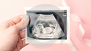 Ultrasound picture pregnant baby photo. Woman hands holding ultrasound pregnancy image on pink background. Concept of