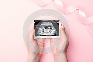 Ultrasound picture pregnant baby photo. Woman hands holding ultrasound pregnancy image on pink background. Concept of