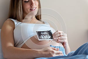 Ultrasound picture pregnant baby photo. Woman holding ultrasound pregnancy image. Concept of pregnancy, maternity