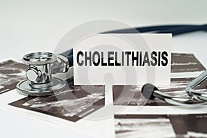 On the ultrasound pictures there is a stethoscope and a business card with the inscription - Cholelithiasis photo