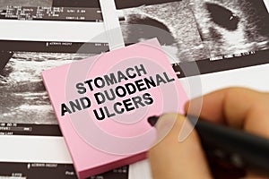 On the ultrasound pictures there are stickers that say - Stomach and duodenal ulcers photo