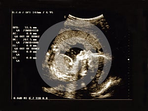 Ultrasound portrait photo