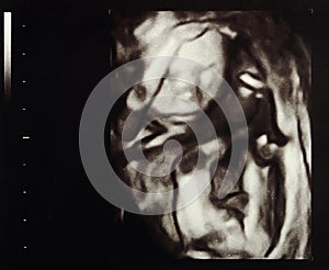 Ultrasound pregnancy photo