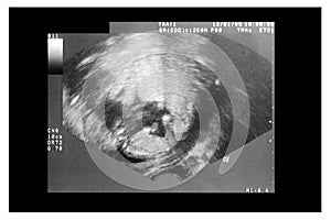 Ultrasound Scan