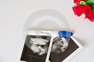 Ultrasound scan of baby and pregnancy test on white background