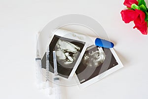 Ultrasound scan of baby and pregnancy test on white background